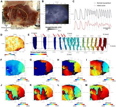 A comprehensive framework for evaluation of high pacing frequency and arrhythmic optical mapping signals